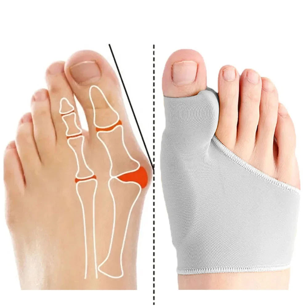 Pro Toe Straightener – Orthopedic Bunion Alignment Tool
