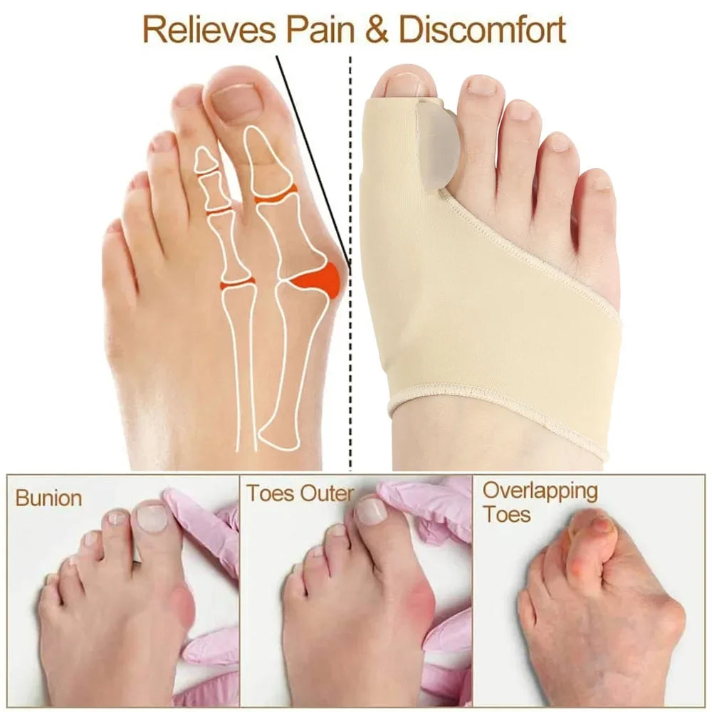 Pro Toe Straightener – Orthopedic Bunion Alignment Tool