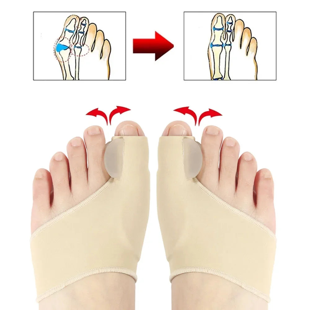 Pro Toe Straightener – Orthopedic Bunion Alignment Tool